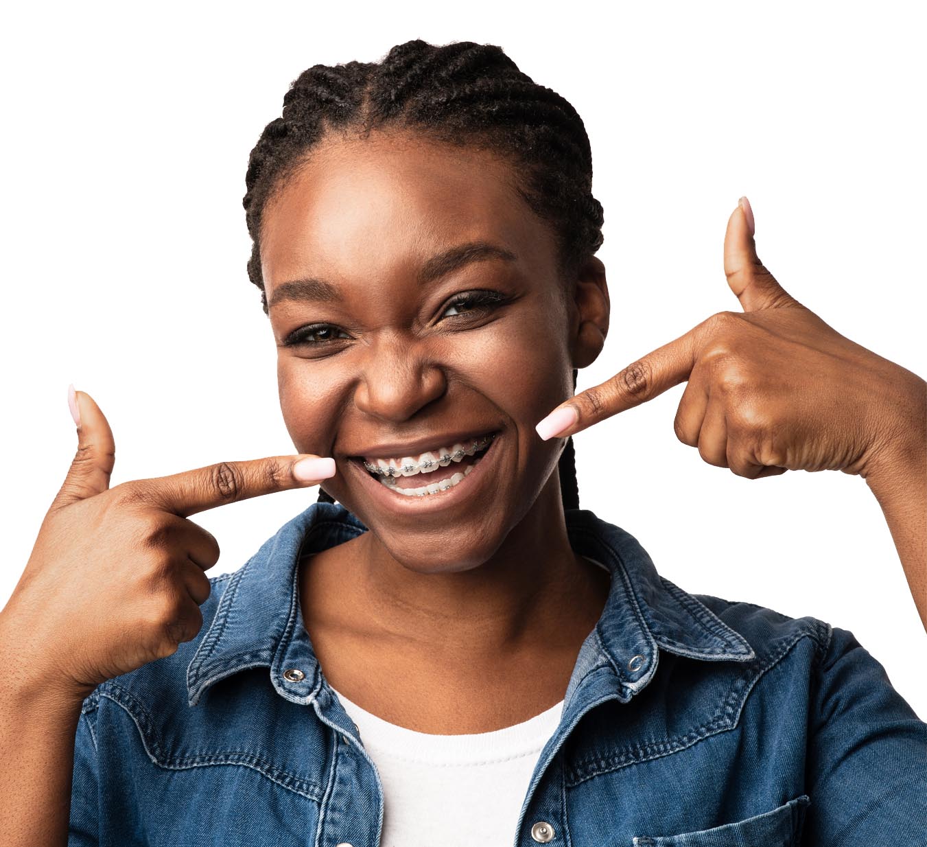 Traditional braces