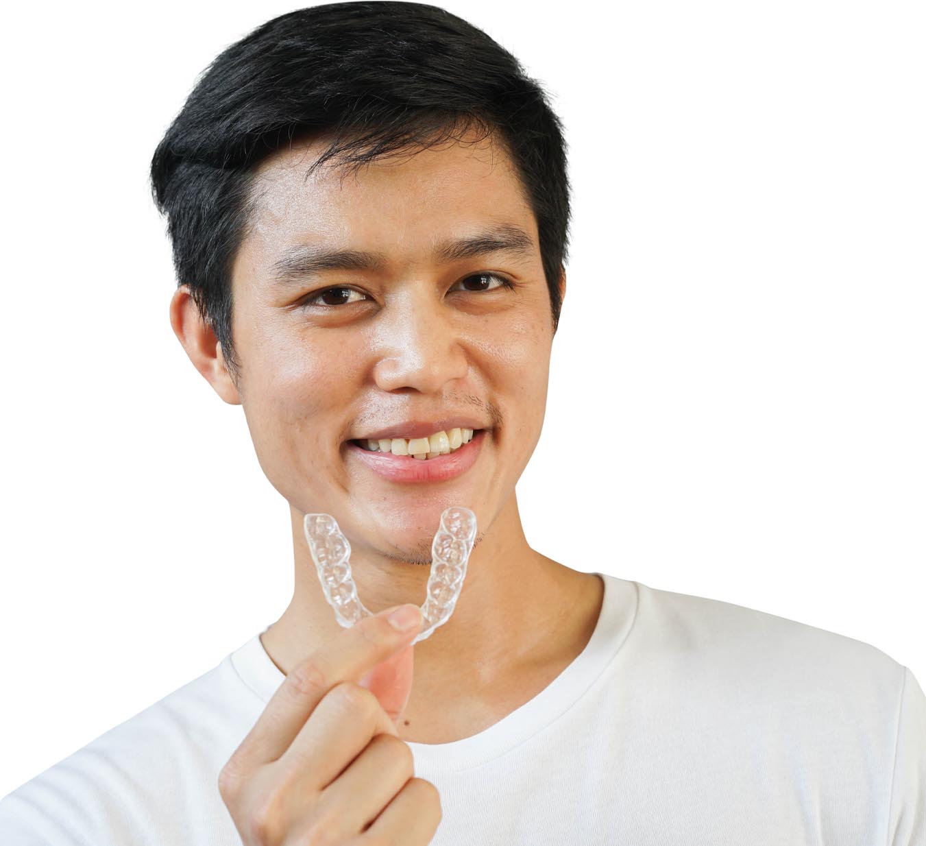 clear aligners