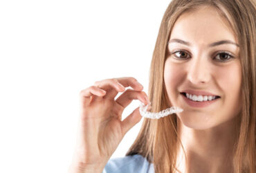 Clear Aligners