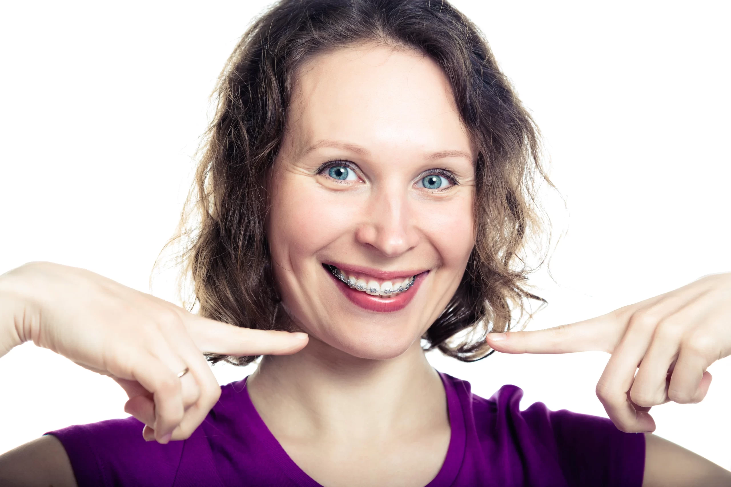 An adult patient showcasing their transformed smile with braces