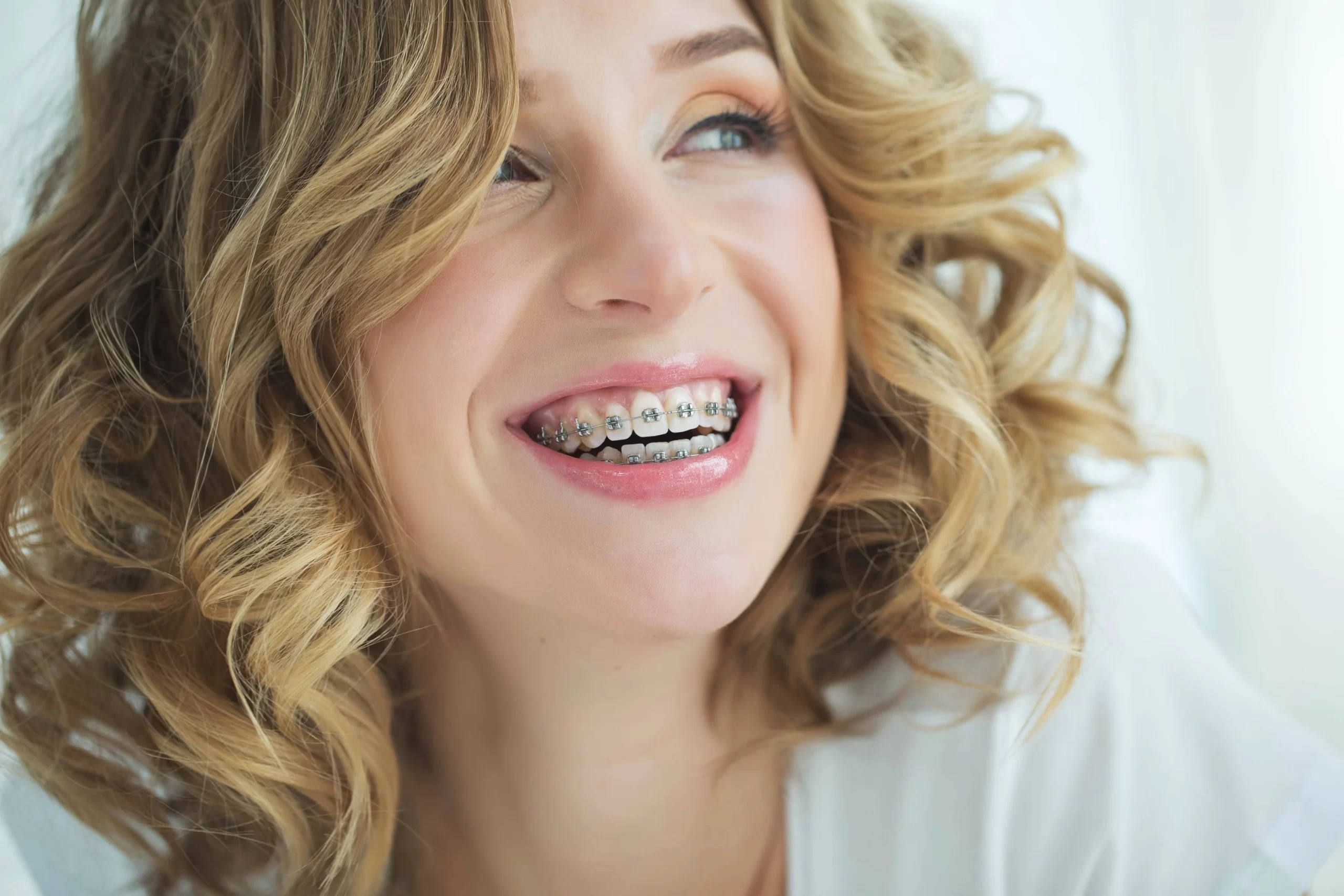 Close-up of traditional metal braces on teeth