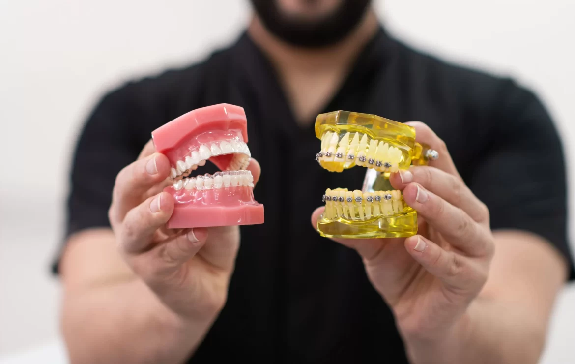 A Comprehensive Overview of Braces Options