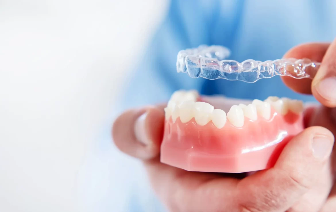 What Is the Cost of Clear Aligners Without Insurance?