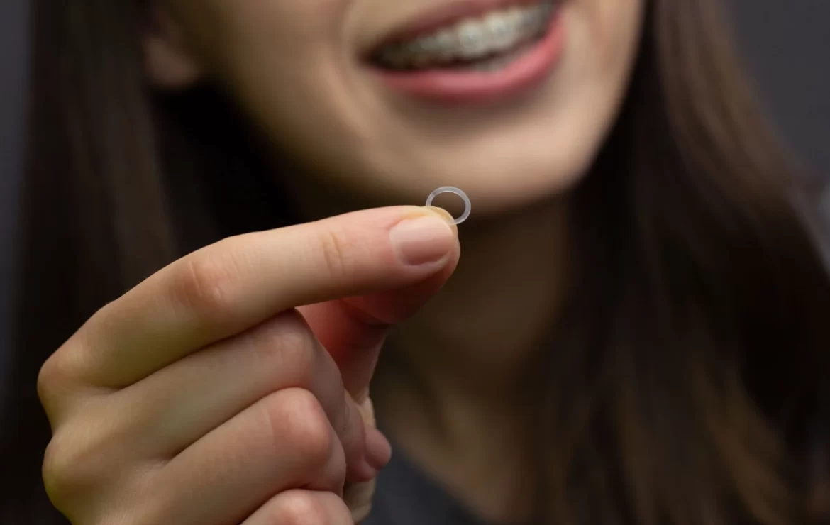 The Importance of Orthodontic Elastics in Achieving a Perfect Bite