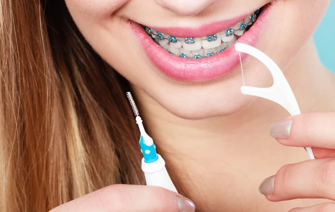 Navigating Your First Week with Braces: Essential Tips for a Smooth Transition