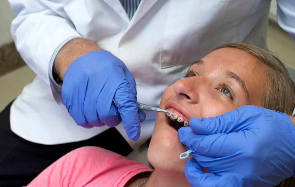 Getting Braces a Second Time: What to Expect