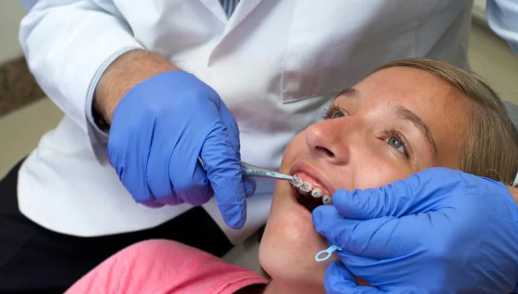 Getting Braces a Second Time: What to Expect