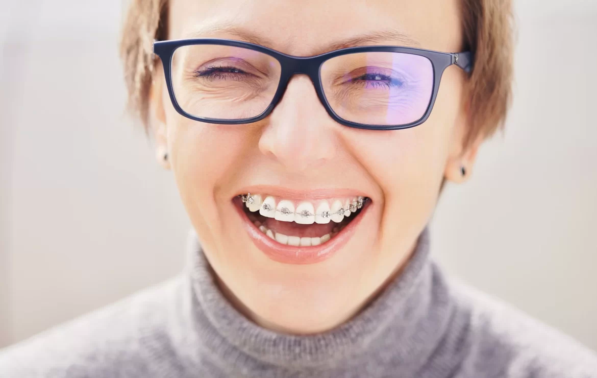 Surprising Benefits of Adult Orthodontics You Might Not Know